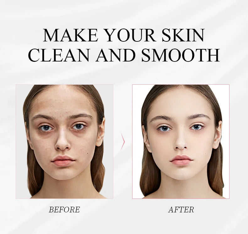 5pcs LAIKOU Japan Sakura Mud Face Mask Anti Wrinkle Night Facial Packs Skin Clean Dark Circle Moisturize Anti-Aging For Facecare