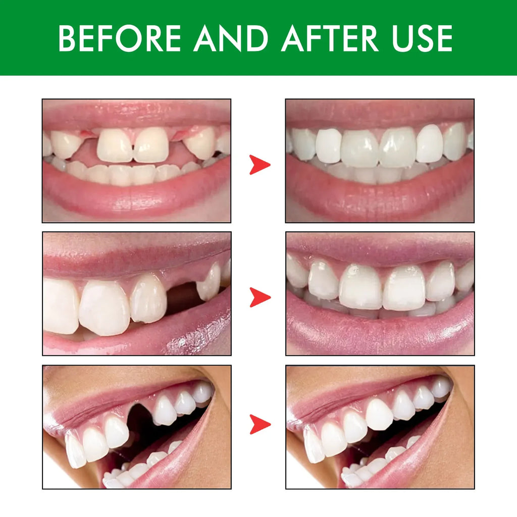 Temporary Tooth Repair Kit Teeth Gaps FalseTeeth Solid Glue Denture Adhesive Teeth Whitening Tooth Beauty Tool for Fix Tooth