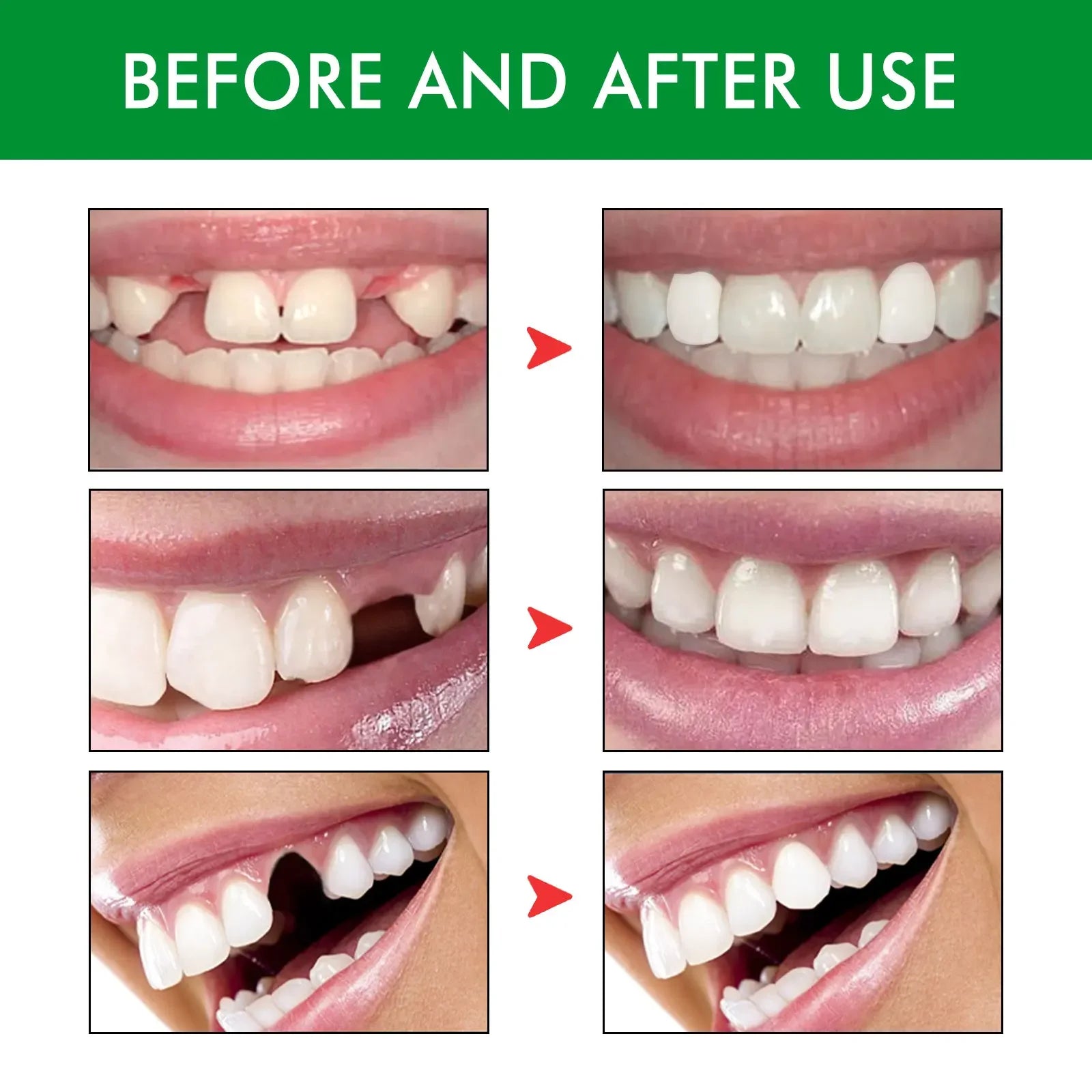 Temporary Tooth Repair Kit Teeth Gaps FalseTeeth Solid Glue Denture Adhesive Teeth Whitening Tooth Beauty Tool for Fix Tooth