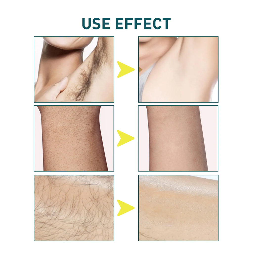 Hair Removal Wax Strips Professional Mild Nonwoven Body Depilation For Face Legs Bikini Underarm Arm Summer Epilator Beauty Tool